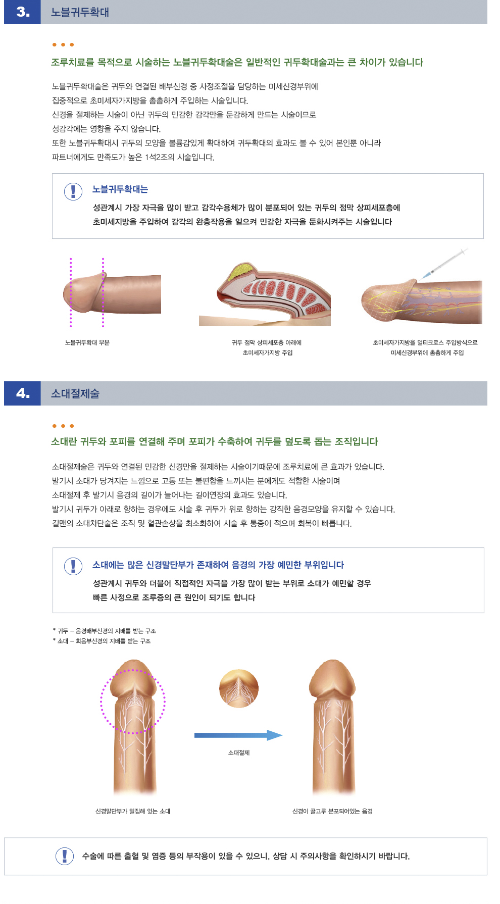 조루수술치료